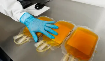 Terapia con plasma de convalecientes puede disminuir la gravedad de COVID-19