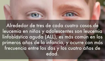 Descubren que un gen puede frenar la leucemia más común en niños