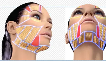 Con Ultherapy dile adiós a las arrugas