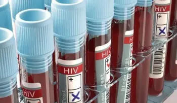 Una vacuna experimental contra el VIH resulta prometedora en animales
