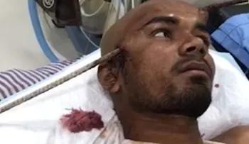El espeluznante accidente de un joven en India; una barra de hierro le atravesó la cabeza y sobrevivió 