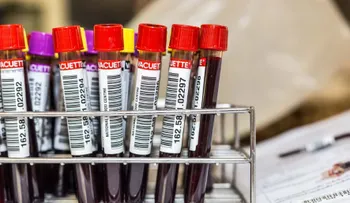  Cáncer de próstata, pulmón y ovario ya se puede detectar con muestras de sangre y orina en RD 
