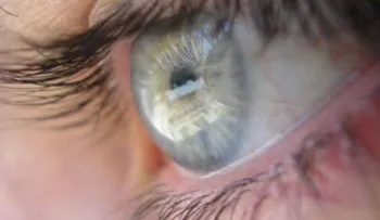 Entérate cómo puedes prevenir las lesiones oculares