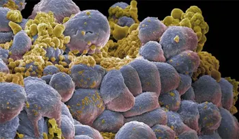 Científicos revelan cuáles son las principales causas del 90% de los casos de cáncer