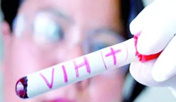 Crean en Rusia una vacuna única contra el VIH