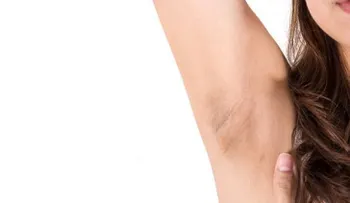 Cómo aclarar las axilas oscuras con 6 remedios naturales