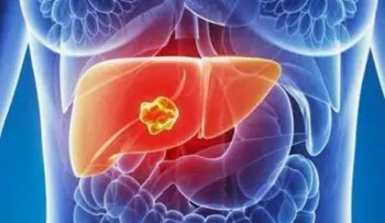 Científicos desarrollan tratamiento genético para aliviar cirrosis