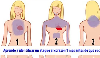 Aprende a identificar un ataque al corazón 1 mes antes de que suceda!