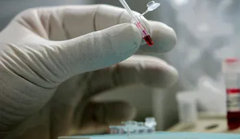 Los científicos alertan sobre un nuevo virus mortal que amenaza al mundo