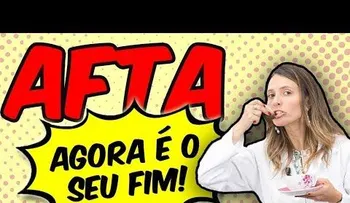 5 muy efectivos consejos para curar las Aftas rápido