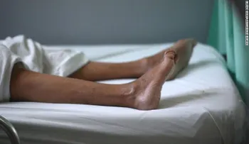 ¿Qué es el síndrome de Guillain-Barré y qué tiene que ver con el zika?
