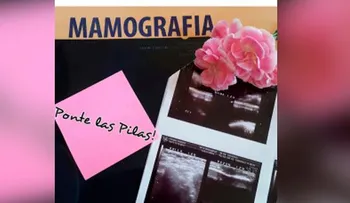 Iamdra Fermín muestra prueba de mamografía