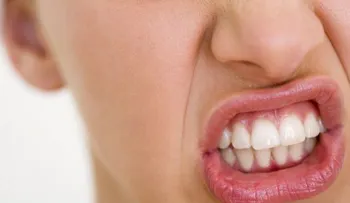 Remedios Naturales para Tratar El Bruxismo, Enemigo Silencioso de tu Sonrisa