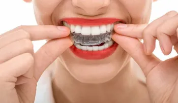 La ortodoncia invisible, alternativa a los brakets (Audio)
