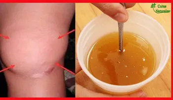 La MEJOR receta que sana tus rodillas y reconstruye huesos y articulaciones 