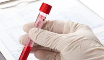 Las personas con sangre O tienen una mayor cantidad de ácidos en el estómago 