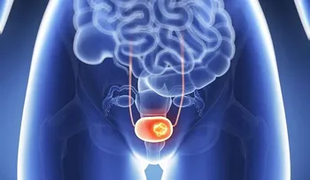 10 síntomas de cáncer de vejiga que cada mujer necesita saber