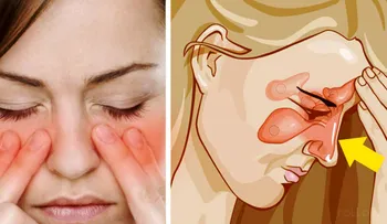 Como curar una sinusitis en sólo 20 segundos con este remedio casero