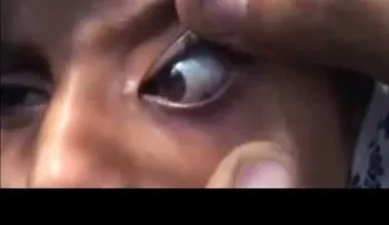 El increíble caso niña llora piedras y que atribuyen a una brujería (VIDEO)