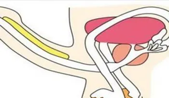 Un super remedio para acabar con tu problema de erección