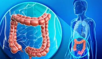 Descubre cómo limpiar el colon de forma natural