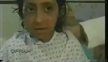 Este hombre se llevó a una niña para operarla: Luego los padres no creían cómo había quedado (VIDEO)