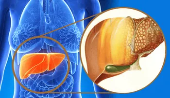 Agua de PASA (uvas secas) para depurar el hígado graso: excelente remedio