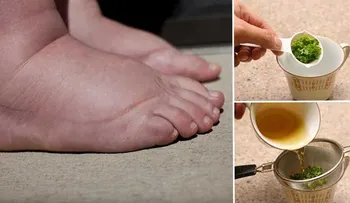 Si retienes líquidos te traemos la solución. Presta atención a esta guía de remedios naturales