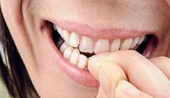 El morderse las uñas puede desencadenar en infecciones y otros daños a los dientes 