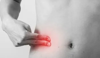 Apendicitis aguda es principal causa de abdomen agudo quirúrgico