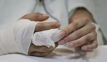  Piden a OMS medidas frontales contra envenenamiento por mordedura serpientes 