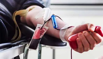 Pacientes con Hemofilia B en riesgo por déficit del factor IX de coagulación