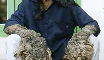 El hombre árbol ¿mito o enfermedad?