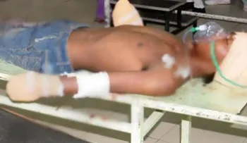 Padre le corta las manos al violador de su bebé de siete meses
