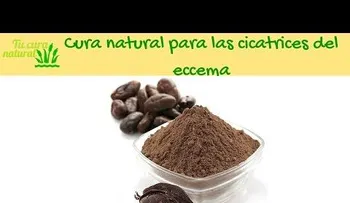 El aceite de oliva cura el ezcema (VIDEO)