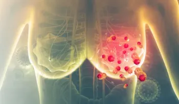 La inmunoterapia logra reducir recurrencia del cáncer de mama más agresivo 