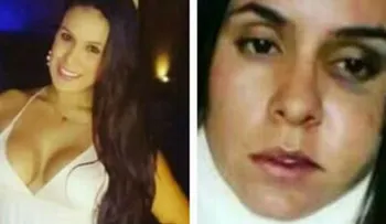 Un modelo colombiana recibe una golpiza de su novio dominicano 
