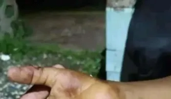 Mujer quema las manos de su hija de 8 años en Pedro Brand, porque dañó un teléfono celular