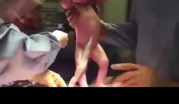 La mujer pidió que le filmaran la cesáreaâ?¦ (VIDEO) 