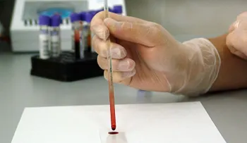  Las maneras sencillas de reducir el riesgo de contraer cáncer encontradas por científicos