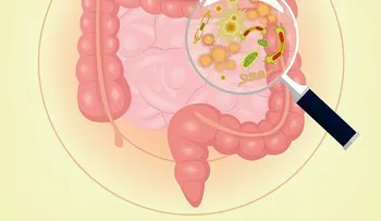 7 signos de que tus bacterias intestinales están fuera de control