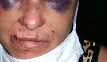 Su novio la quiso matar cuando dormía, pero se resbaló con la sangre y está viva de milagro 