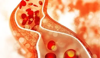 EEUU aprueba nuevo medicamento contra el colesterol y estudia vacuna para el coronavirus