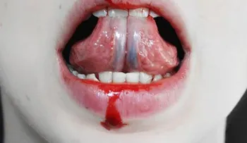 La misofonía: así se llama la furia que sientes cuando escuchas a alguien masticar 