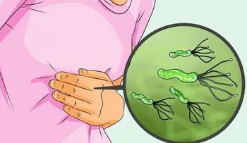 Médico japonés publica cómo eliminar la bacteria Helicobacter Pylori fácilmente 