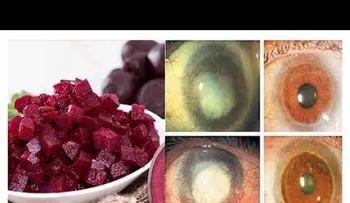 El vegetal que te devuelve la visión, limpia el colon y desaparece la grasa