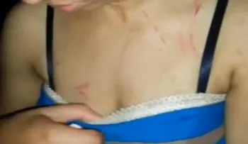 Joven denuncia fue agredida por vecino que dice estar pegado con el Gobierno 