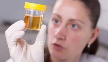 Qué dice el color de tu orina sobre tu salud
