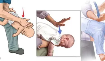 Los pasos a seguir si un niño se está ahogando con un alimento