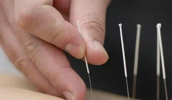 Encuesta Ciencia: La mitad de los españoles confía en acupuntura y homeopatía